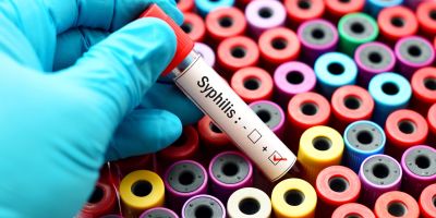 Syphilis-Test-headerbild