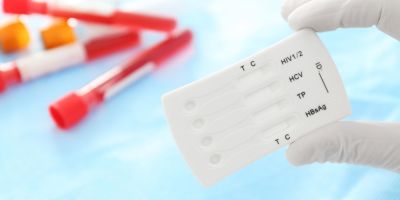 HIV-Test-headerbild