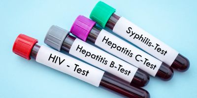 Hepatitis B/C-Test-headerbild